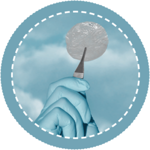 Omnilenz amniotic membrane